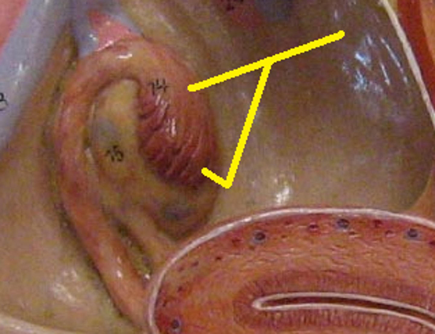 <p>small, fingerlike projections at the end of the fallopian tubes, through which eggs move from the ovaries to the uterus</p>