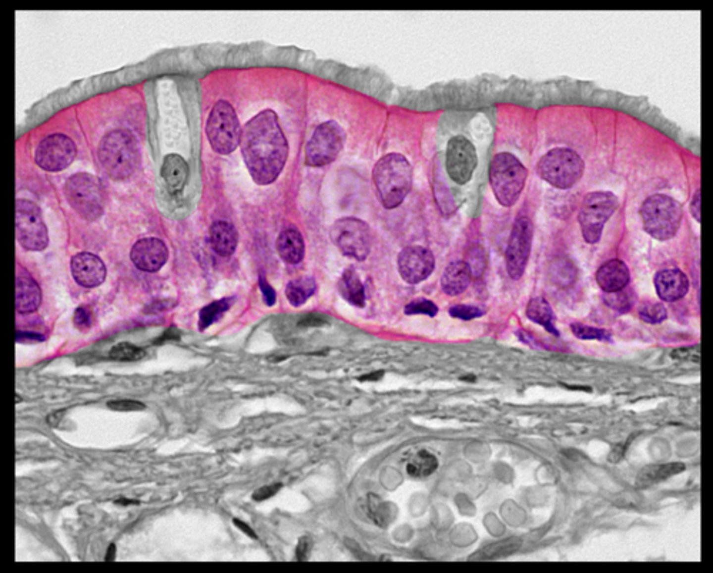 <p>throughout the respiratory tract</p>