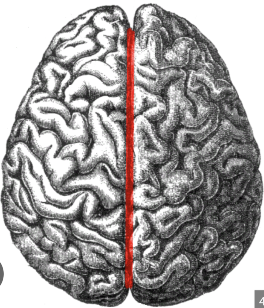 <p><span style="background-color: transparent;"><span>big separation between the cerebral hemispheres</span></span></p>