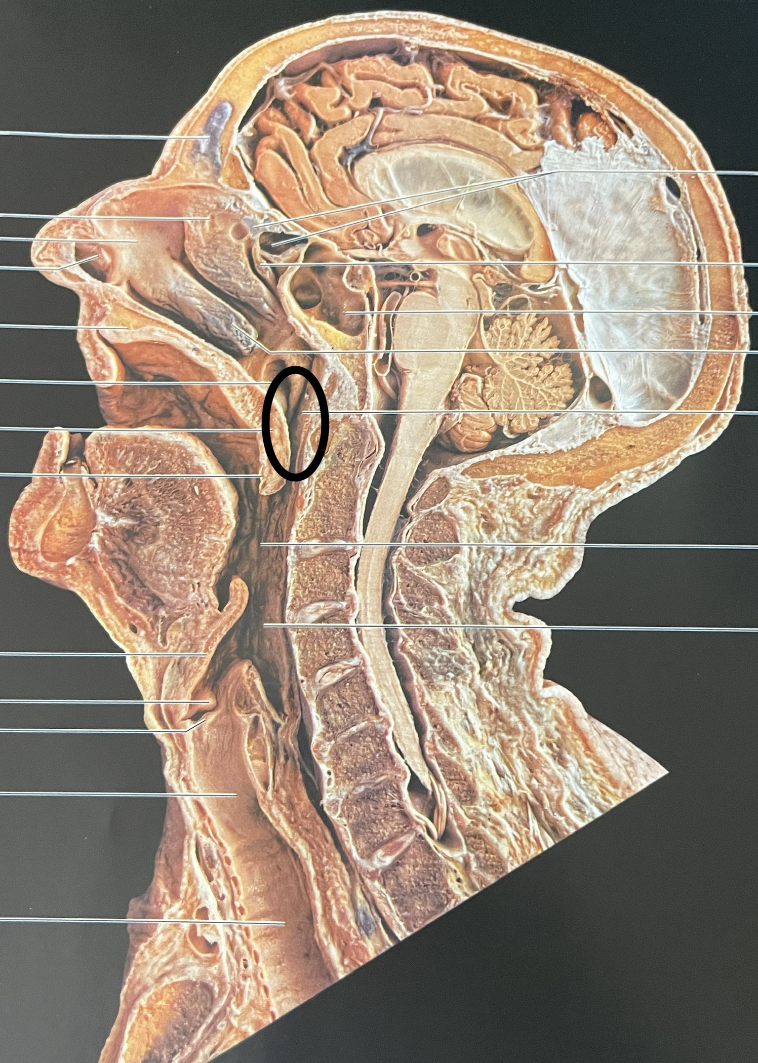 between nasal cavity and back of throat