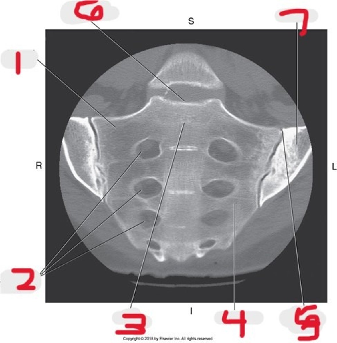 <p>Name all numbered structures</p>