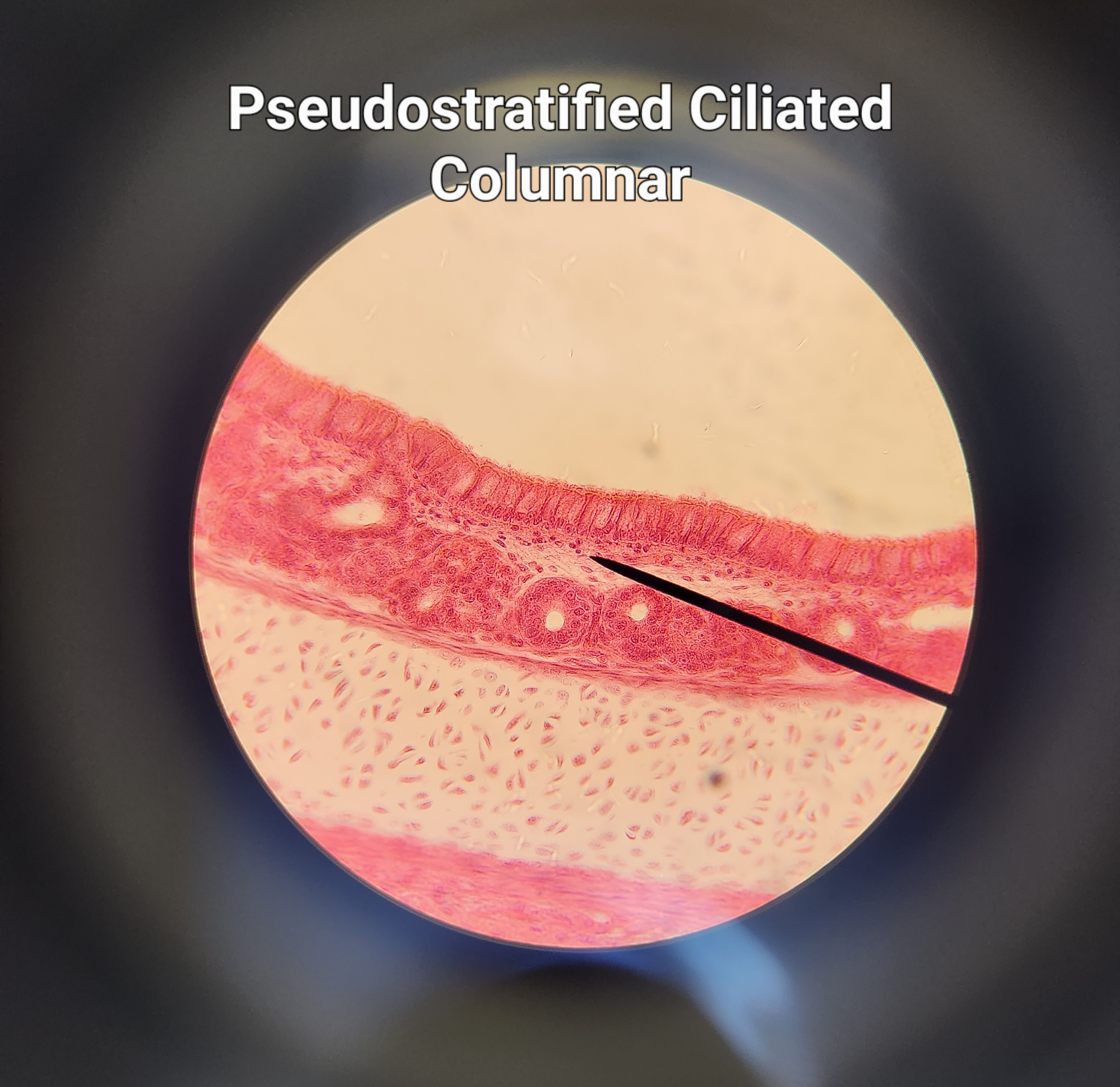 1 layer of rectagular cells (but looks like 2 or more) and has cilia on apical surface