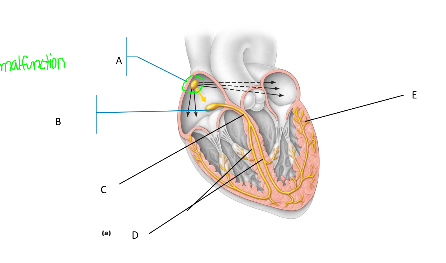 <p>Malfunction? </p>