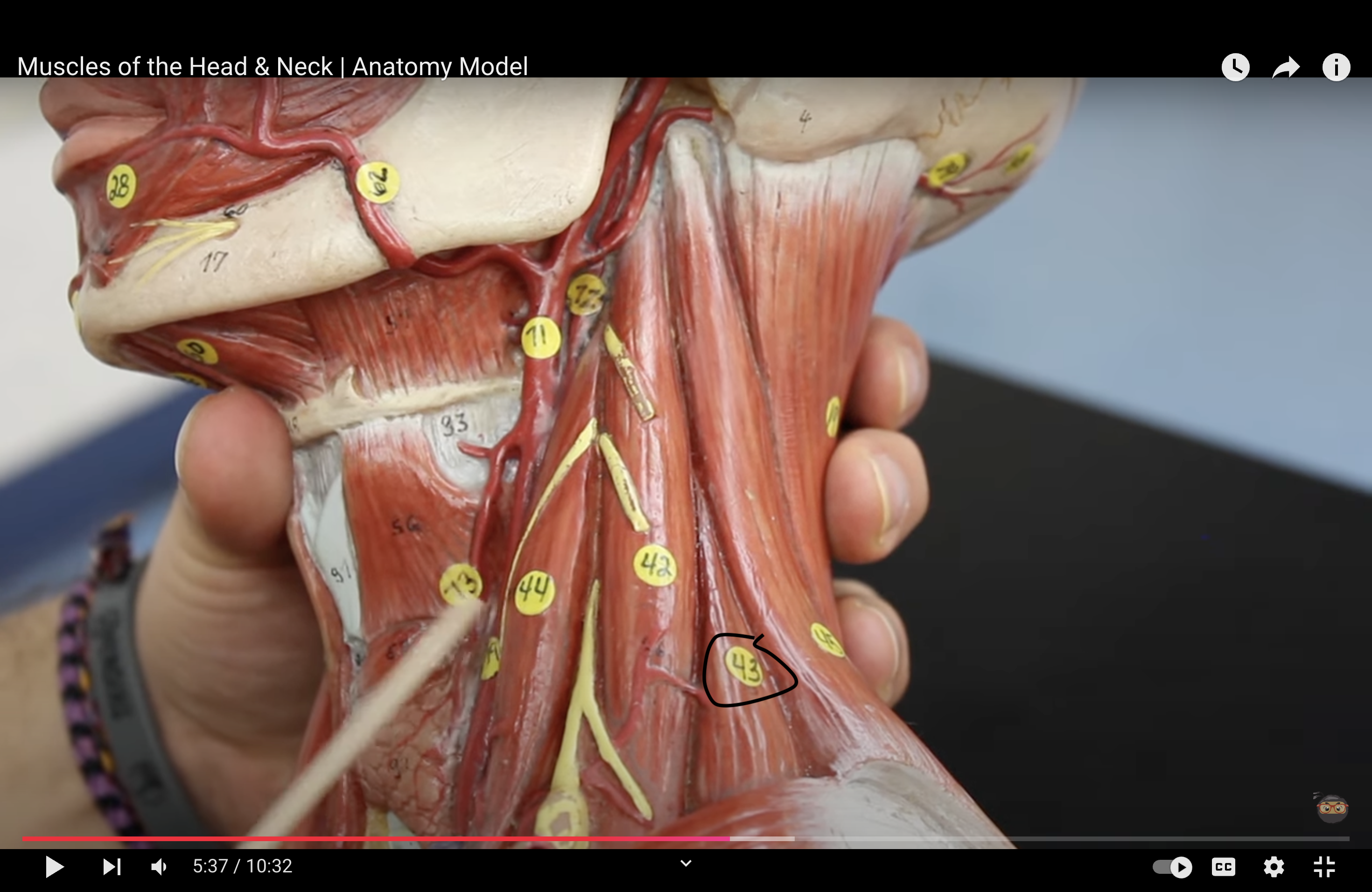 <p>What muscle is this?*****</p>