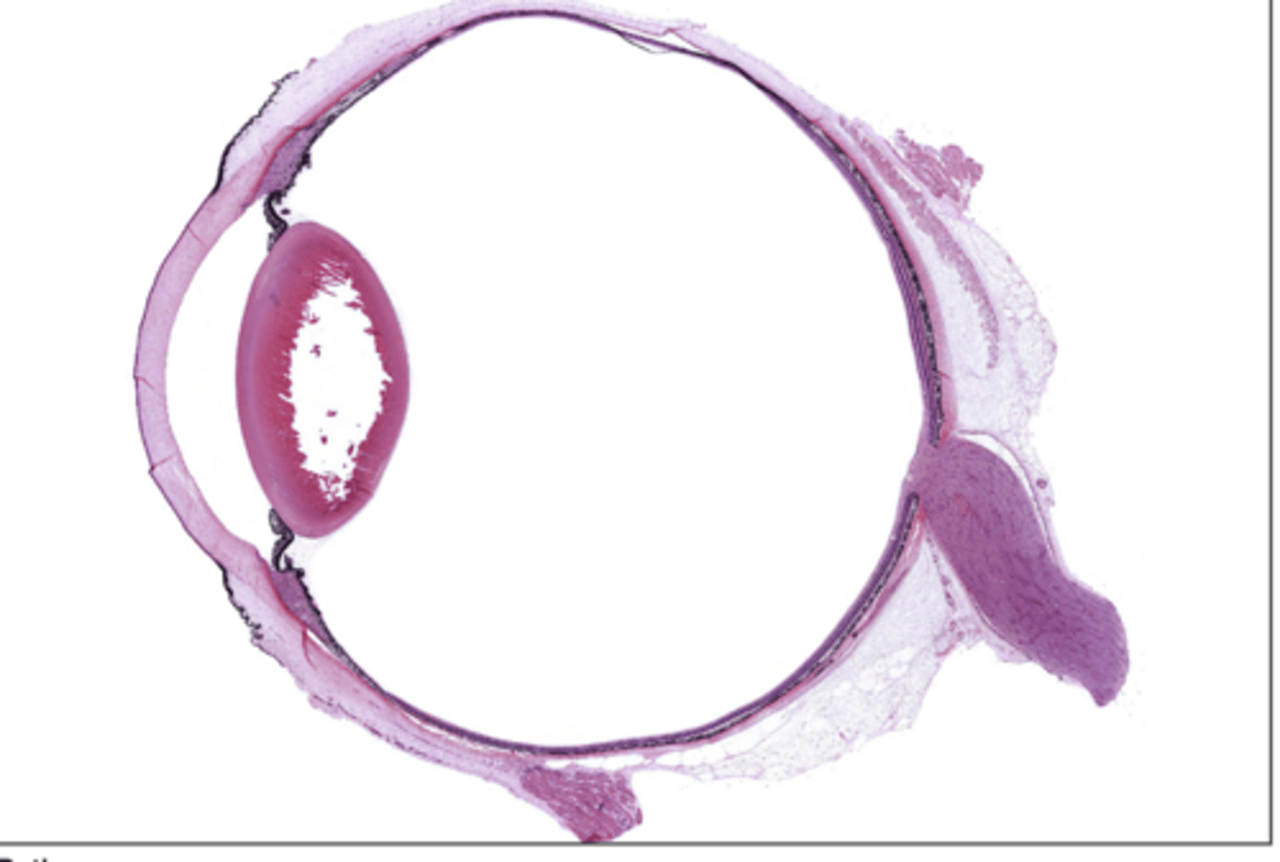 <p>inside lining around back of eye (specialized cells are here)</p>
