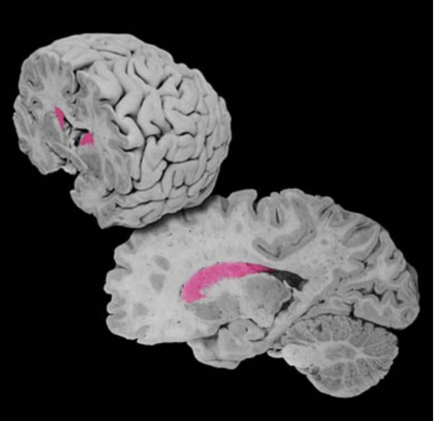 <p>Caudate nucleus</p>