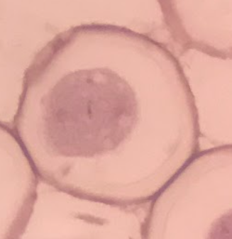 <p>stage of fertilization</p>