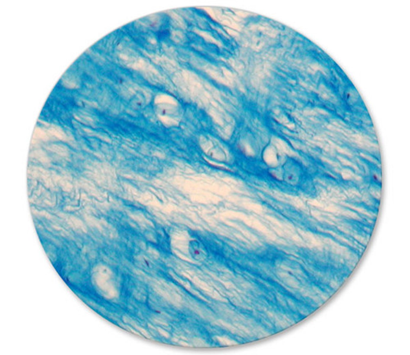 <p>Fibrocartilage</p>