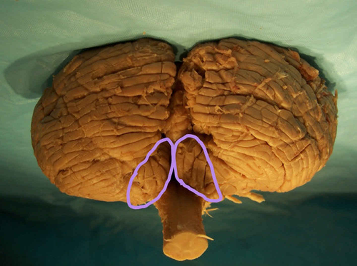 <p>identify the structure</p>