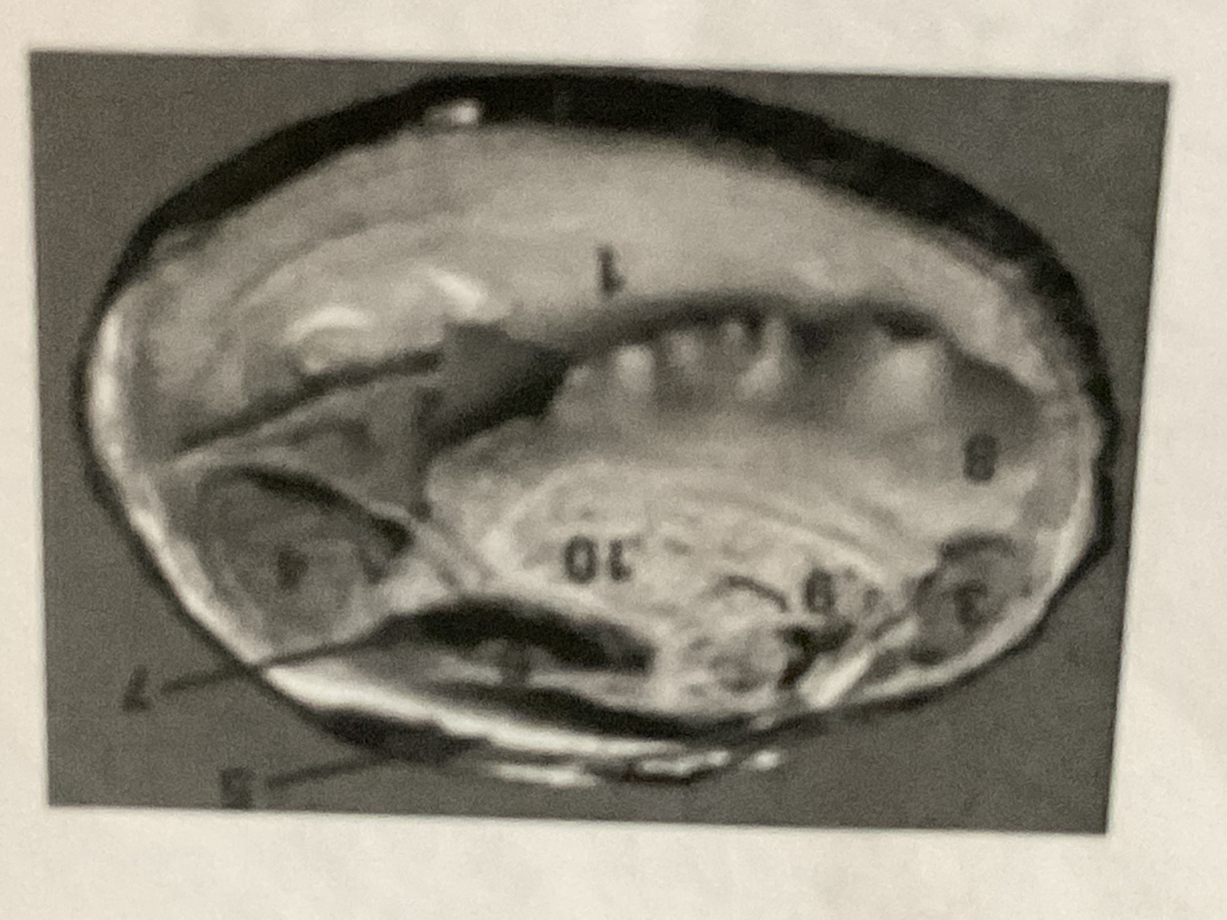<p>what is number 3 in clam?</p>