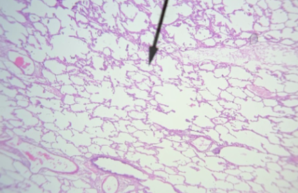 <p>what type of tissue is this </p>
