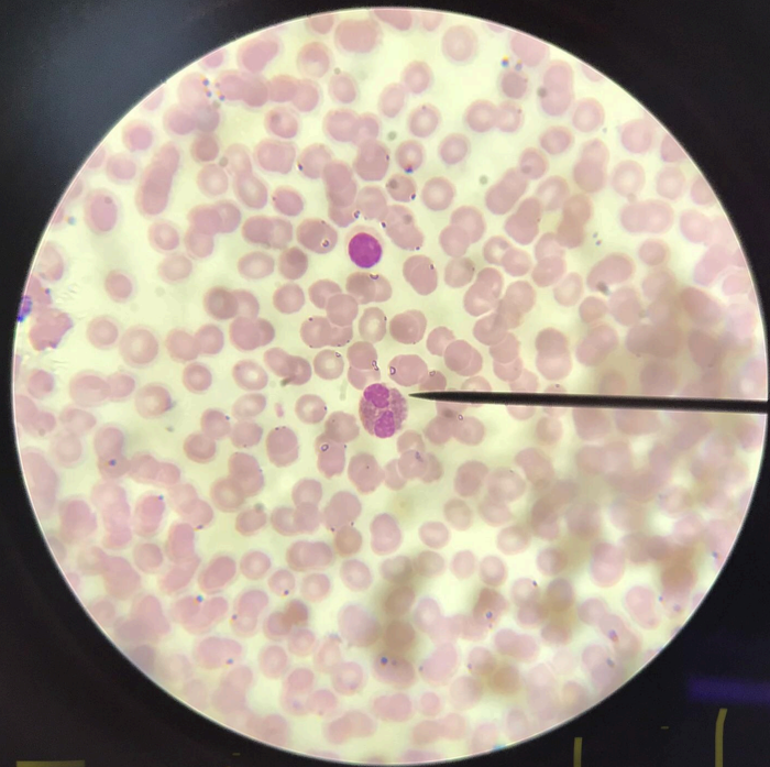 <p>spherical in shape; cytoplasm stains bright red with acid dyes; nucleus is two oval bodies connected via thin chromatin thread; detoxification role</p>