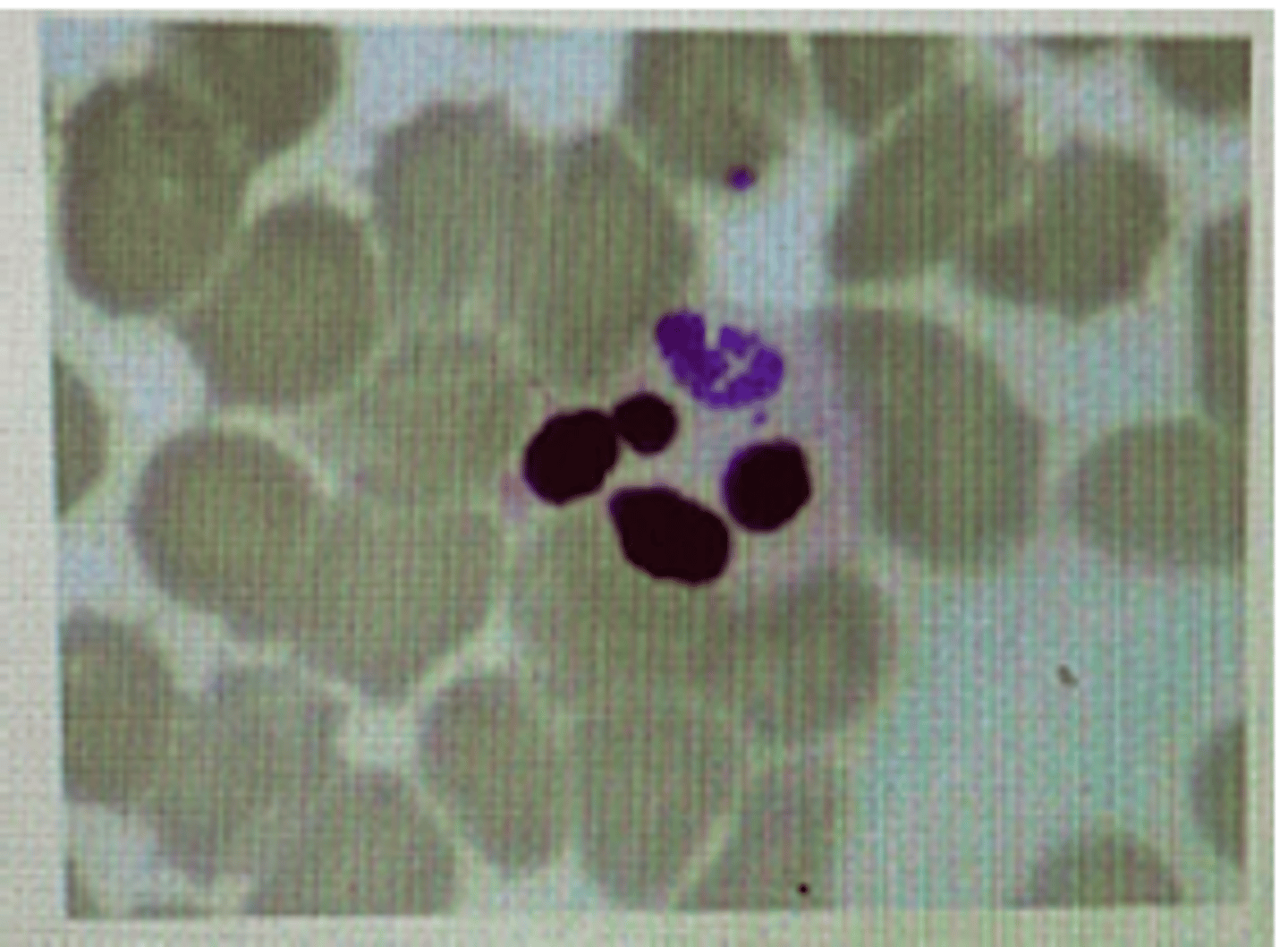 <p>How is the illustrated pathogen transmitted?</p><p>a. Transplacental</p><p>b. Blood transfusion</p><p>c. Mosquitoes</p><p>d. Culicoides species</p><p>e. Ixodes species</p>