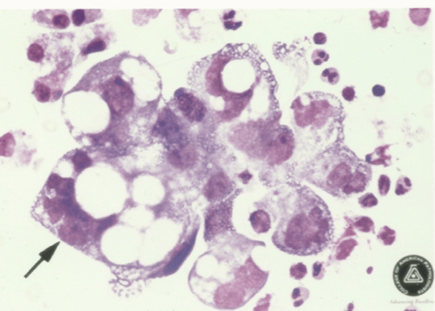<p>Identify the cells in this body fluid</p>
