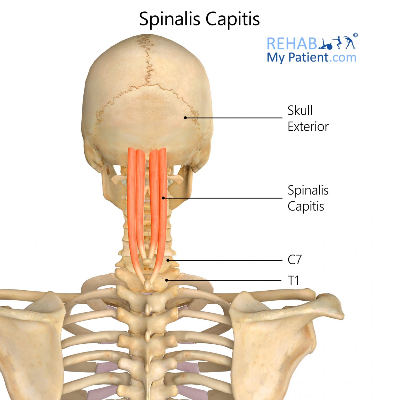 <p><strong>Proximal + Distal Attachment</strong></p><p>Spinous process to spinous process as distal as L2 (fibers cross over multiple levels)</p><p><strong>Peripheral Innervation</strong></p><p>posterior rami of spinal nerves</p><p><strong>Action</strong></p><p>Back extension (FYI for lab: well developed in thoracic region ONLY)</p>