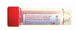 <p>Sample Storage and Preservation&nbsp;- Urine </p>
