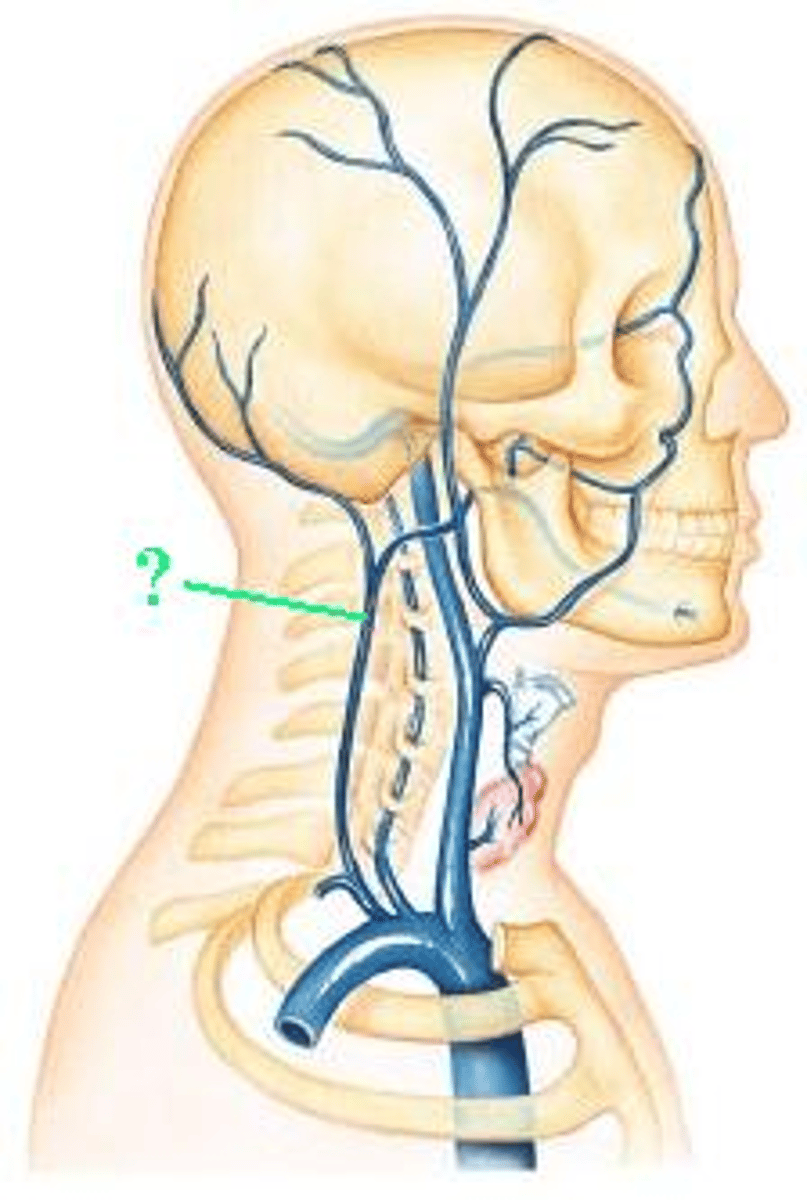 <p>Identify the indicated blood vessel.</p>