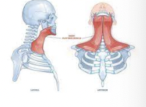 <p>What muscle is this?</p>