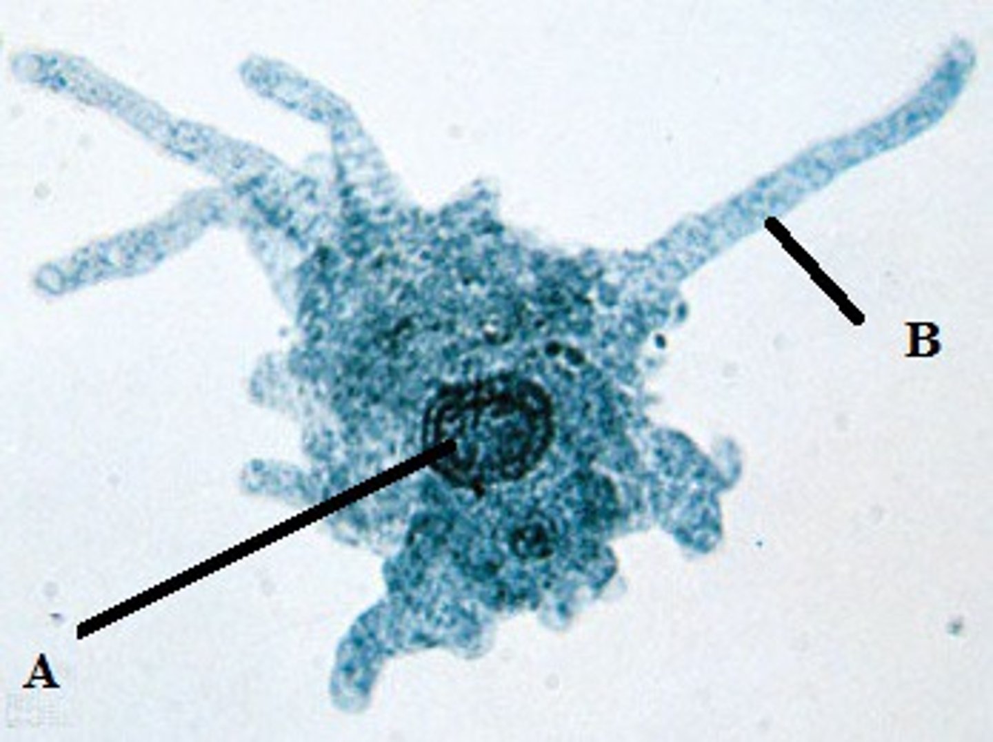 <p>Identify this organism, their kingdom and phylum.</p>
