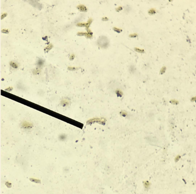 <p>What is the primary virulence mechanism of this special structure?</p>