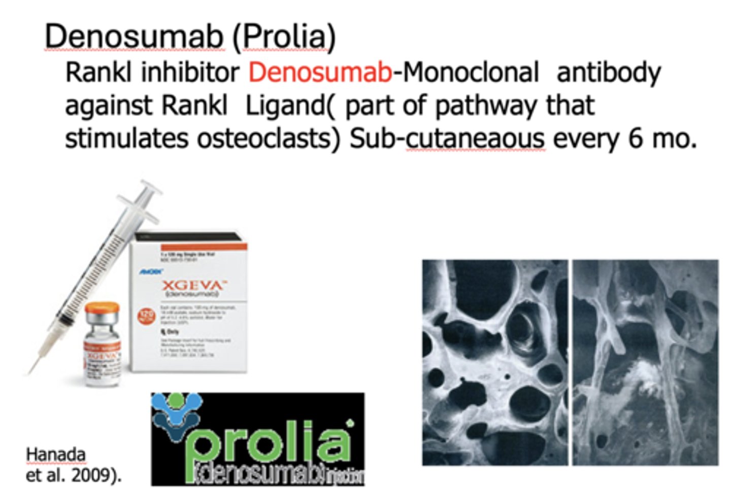 <p>Denosumab (Prolia)</p>
