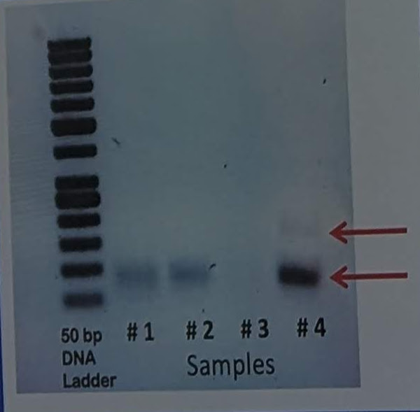 <p>Four persons perform a PTC taste analysis by amplifying the TAST38R gene harboring the Fnu4HI enzyme site. You observe the sample on the gel below after digestion of the enzymes for sample 4: The phenotype of this person would be a…?</p>