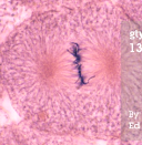 <p>nuclear membrane/envelope disintegrates, sis chromatids line up along metaphase plate with help from spindle fibers</p>