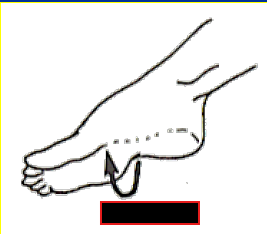 <p>What Movement is occurring?</p>