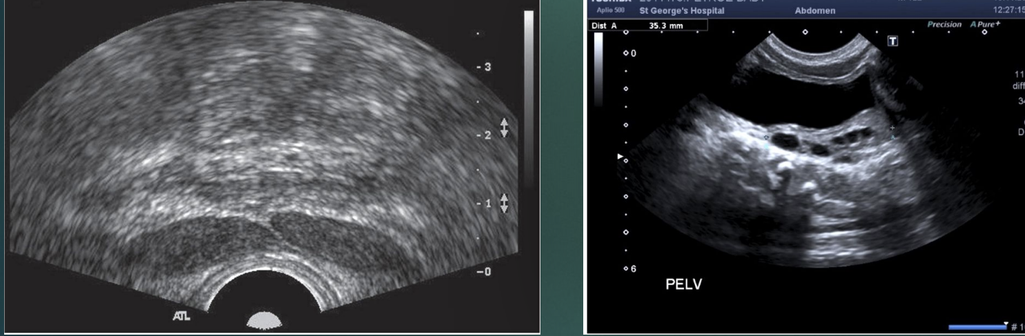 <p>These 2 images are showing?</p>