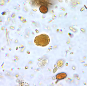 <p>Professor: Dr. Glena Fe A. Yapchulay-Alcabasa</p>