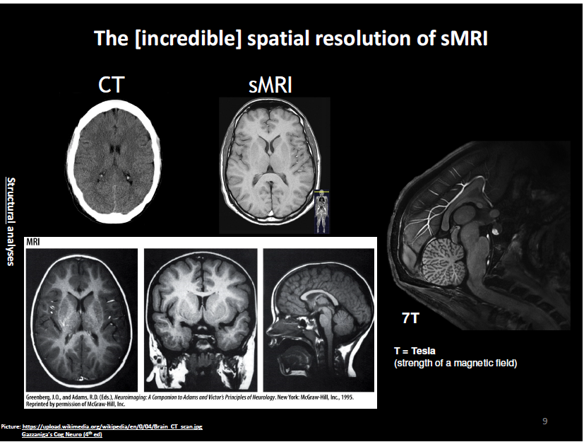 <p>shows the structure of the body</p><p></p><p>why is this useful?</p><ul><li><p>when atoms are in solid like bone, they don’t go very far (low measure of resonance) but in fluid, they will go farther</p></li><li><p>incredibly detailed and shows every single level of the brain in every single cut</p></li></ul><p></p>