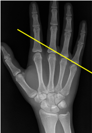 <p>Q what is the name of this measurement? and what is the average + range?</p>