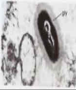 <ul><li><p><span>General term for the thick cover or layer of polymers deposited outside the cell.</span></p></li></ul><p><span style="color: blue">If we translate that into common terminologies its just a "carbohydrate coding", its a thick layer that surrounds your cell wall, this is your cell wall, the black is the border, this part here the colorless membrane that surrounds the cell wall, thats your glycocalyx membrane.</span></p>