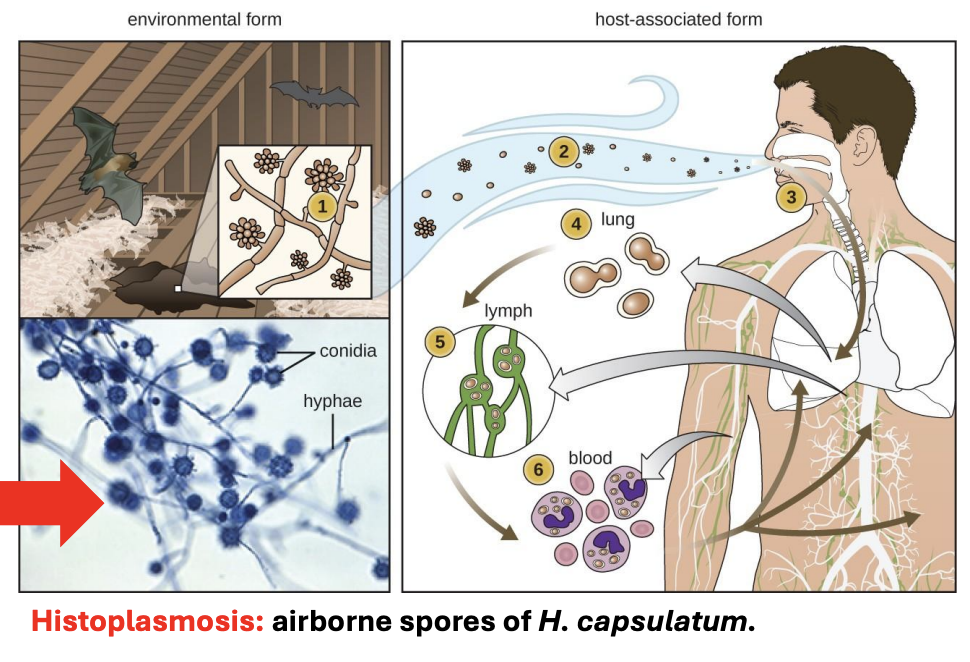 <p>Explain<strong> mechanism of <em>Histoplasma capsulatum</em> that causes histoplasmosis </strong>mostly in construction workers</p>