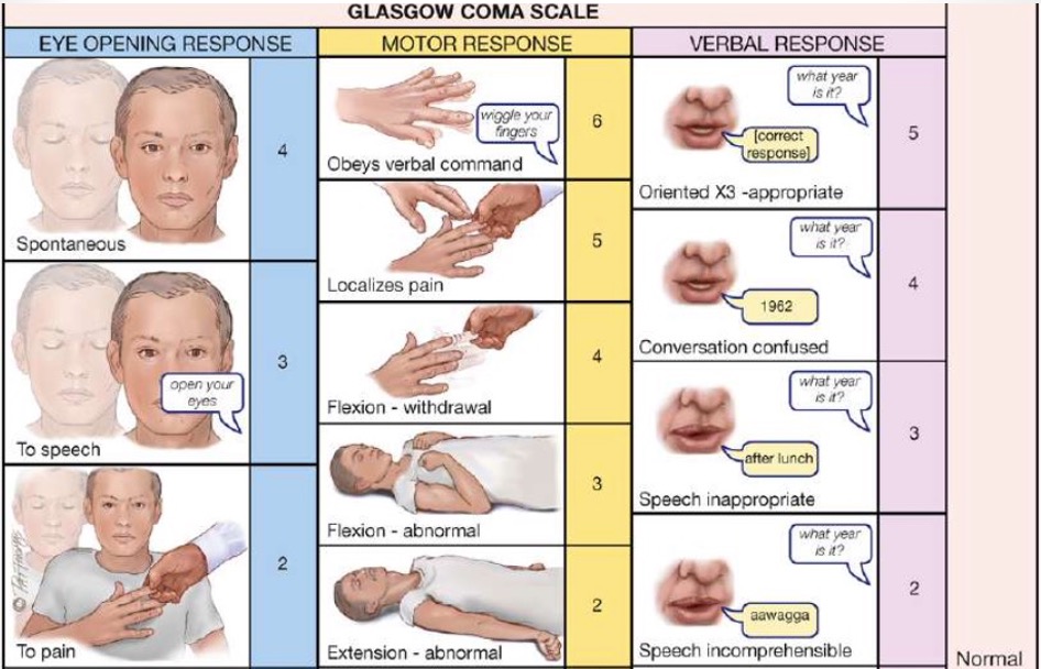 <p>LOC: assess orientation (person/place/time) and speech - patient is alert and oriented x3, speech is clear and unbroken.</p><p>Motor Function: have patient squeeze both hands, &nbsp;have patient push their foot down (gas pedal) while resisting with your hand - motor function intact and streng is equal bilaterally.</p><p>Pupillary Response: shine light in each eye - pupils equal, round, and reactive to light.</p><p>Vital Signs: assess BP, HR, RR, T, SpO<sub>2</sub>.</p><p>Glasgow Coma Scale (GCS): score out of 15 - GCS 15/15.</p>