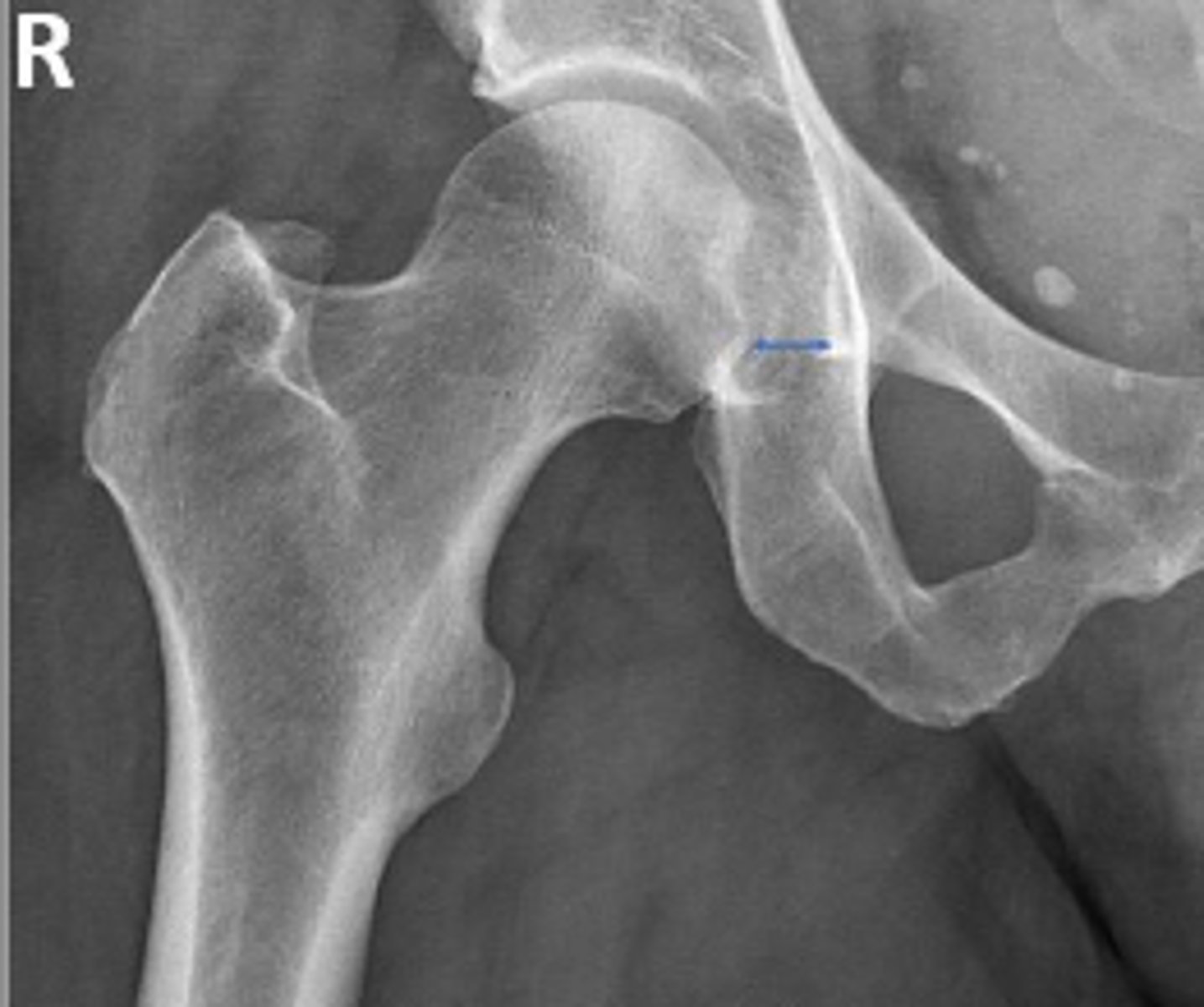 <p>What is the normal range for this assessment?</p>