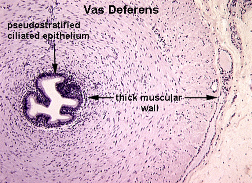 <p><strong>Vas deferens</strong></p><ul><li><p class=""><strong>Pseudostratified columnar epithelium</strong> with <strong>stereocilia</strong></p></li><li><p class=""><strong>Small, irregular lumen</strong> compared to thick wall</p></li><li><p class="">Surrounded by a <strong>very thick muscularis</strong> with <strong>three layers</strong>: inner longitudinal, middle circular, outer longitudinal</p></li><li><p class="">Often has a <strong>folded mucosa</strong></p></li></ul><p></p>