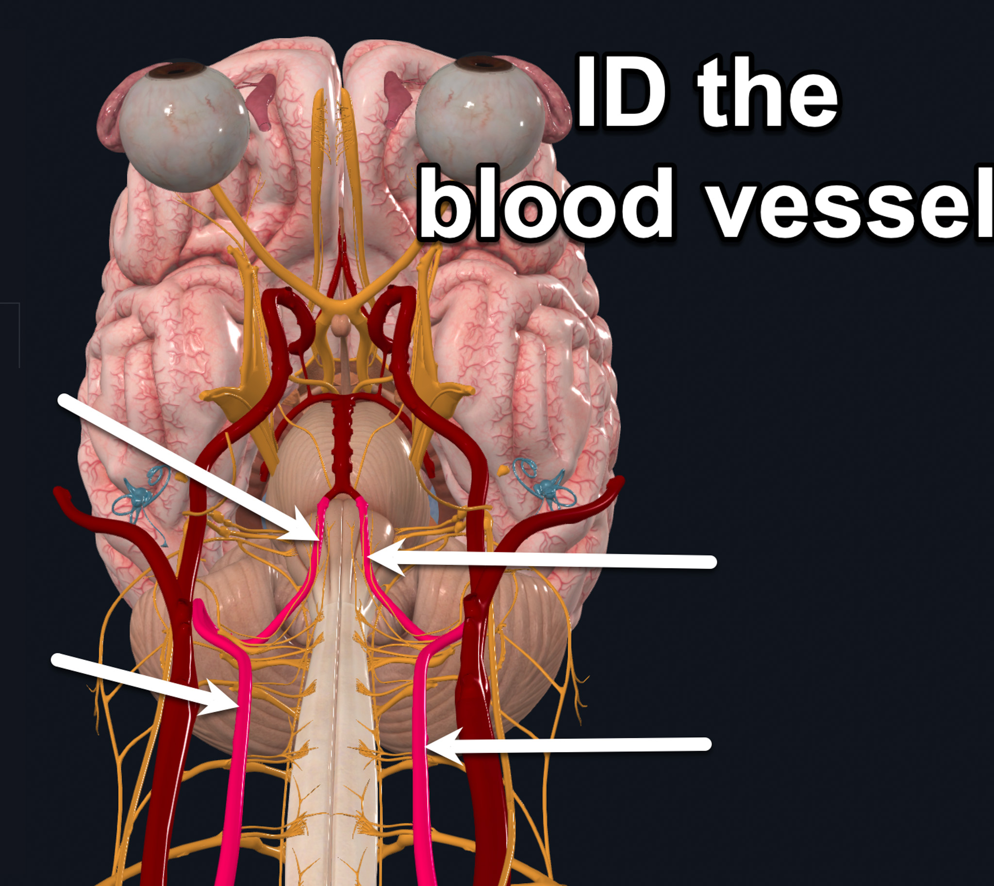 term image
