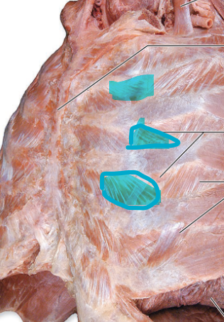 <p>Internal Intercostals</p>