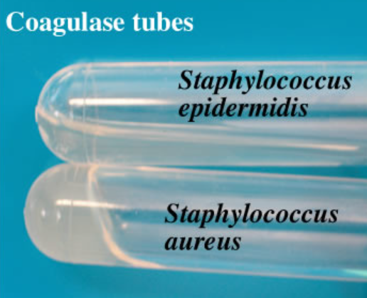 a few drops of plasma with added citrate in a small tube or on a slide can test for the enzyme coagulase because it will cause the liquid to clump or gel. Only S. aureus makes the enzyme but not S. epidermidis
