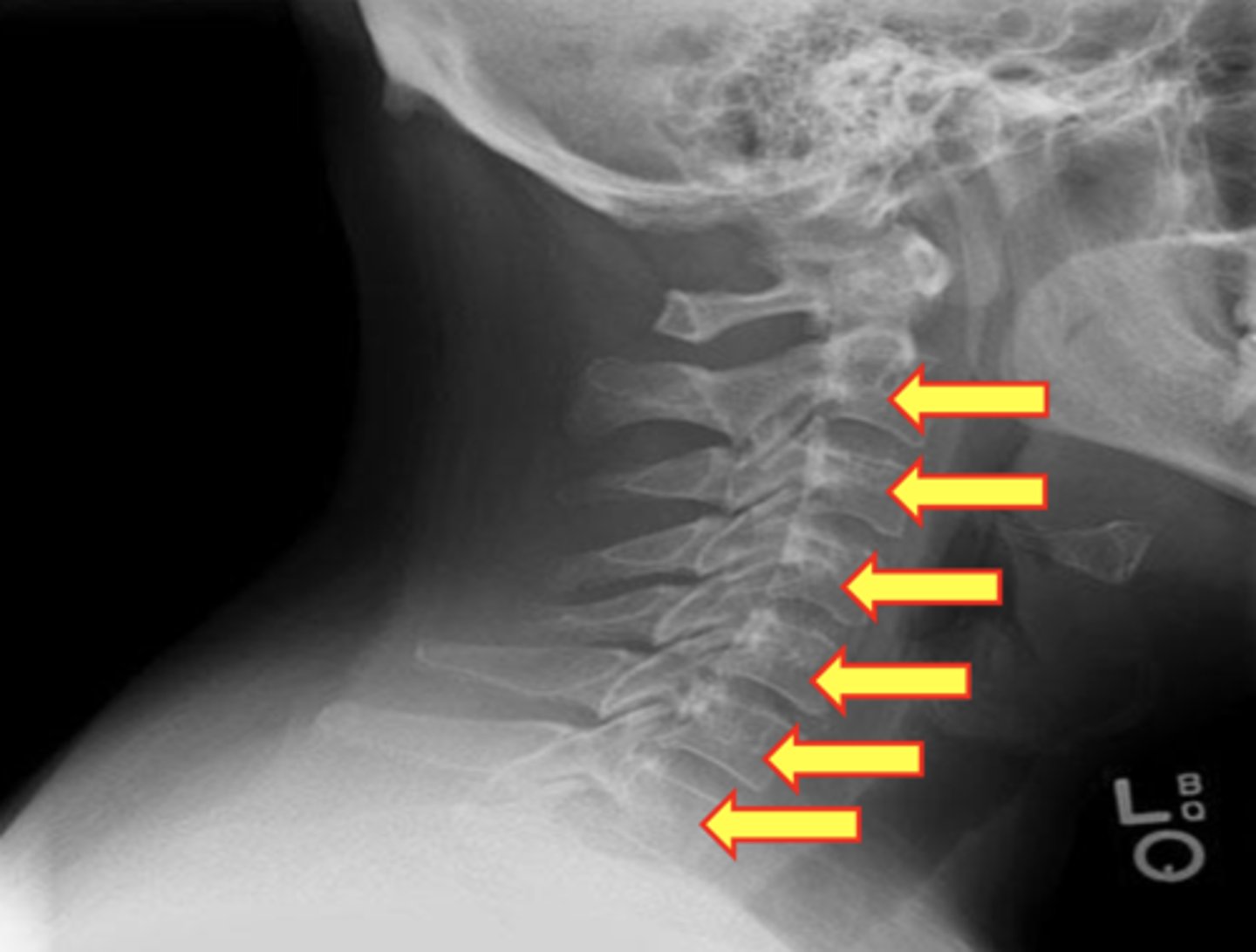<p>What are the yellow arrows pointing to?</p>