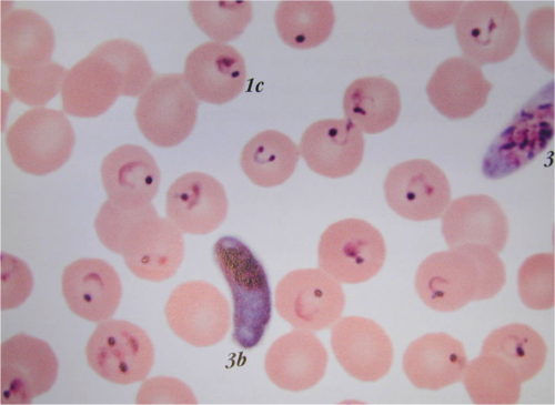 All are parasitic
No true means of locomotion 
Ex: Malaria