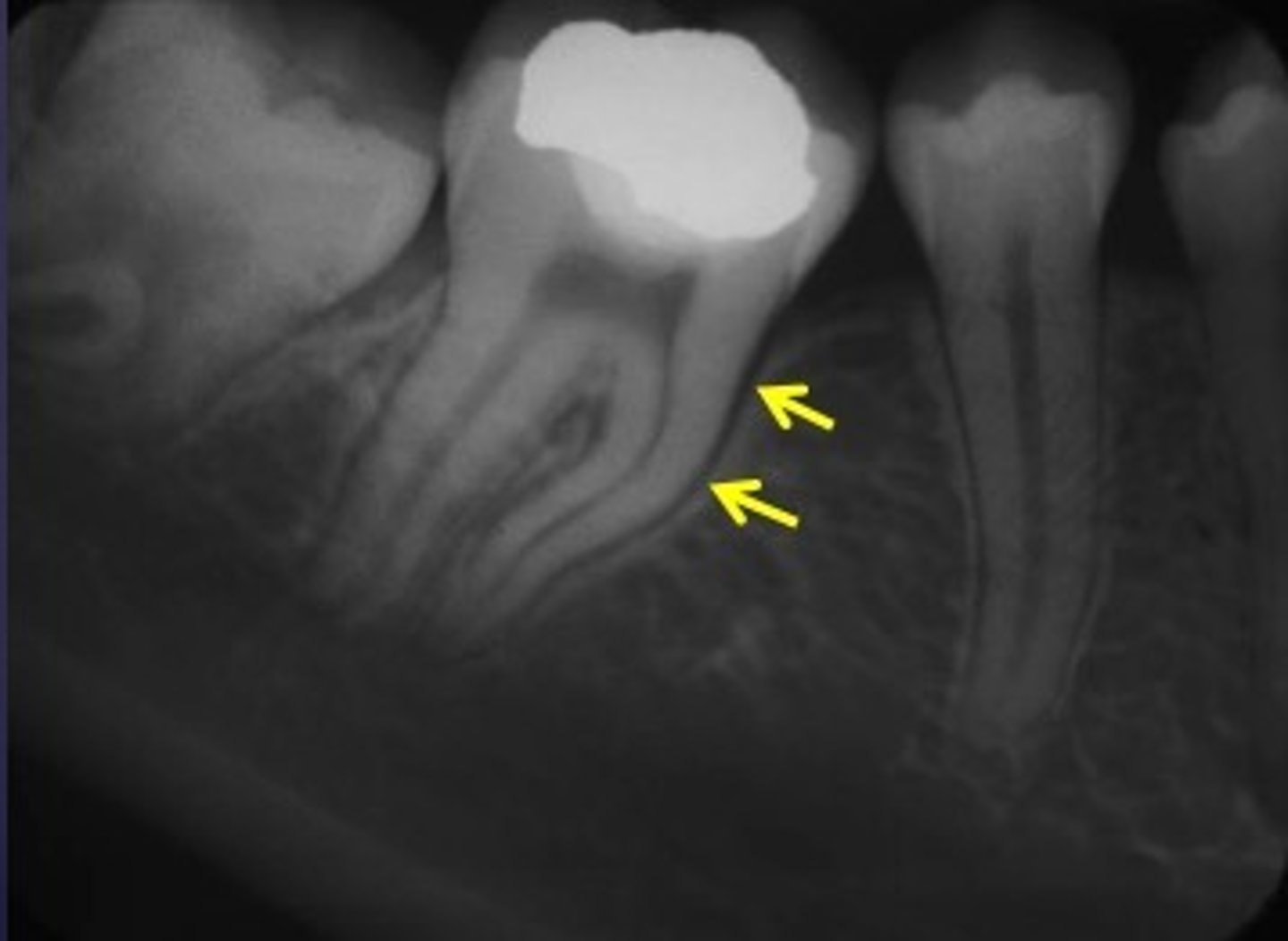 <p>Identify soft tissue</p>