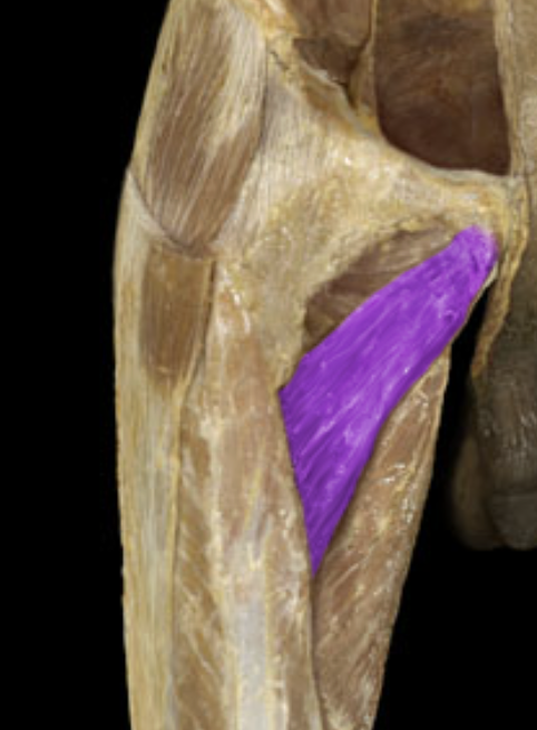<p>What is/are this muscle’s origin(s)?</p>