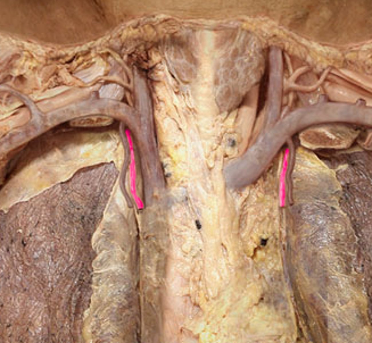 <p>runs deep to the costal cartilages to supply the anterior chest walls</p>