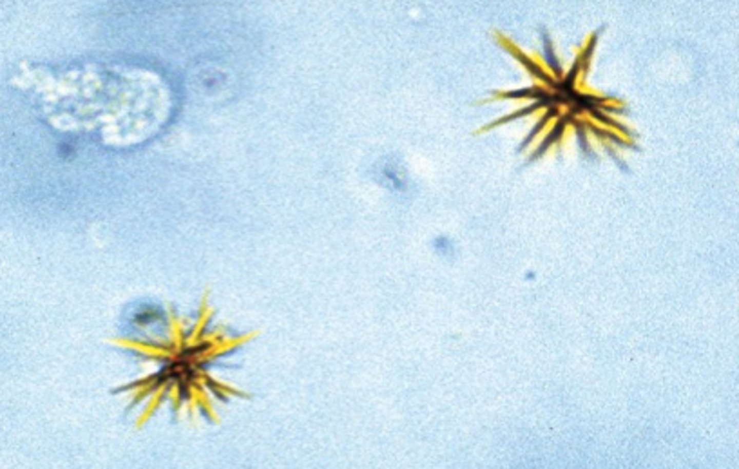 <p>Bilirubin Crystals</p><p>-Chemical tests for bilirubin should</p><p>be pos.</p>