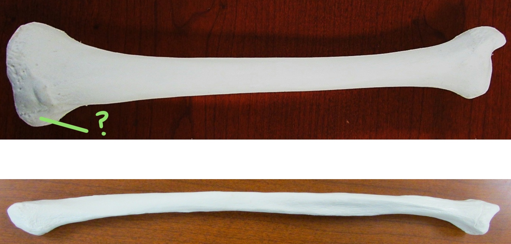 <p>Determine the part of the Tibia highlighted</p>