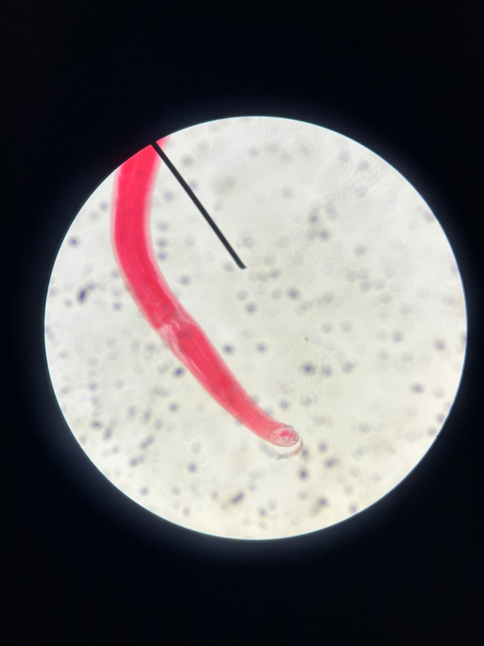<p>Ancylostoma caninum,</p>