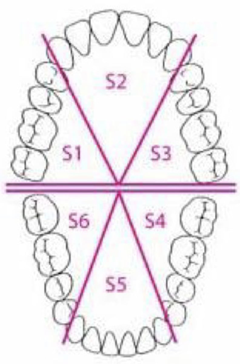 <p>maxillary right posterior, maxillary anterior, maxillary left posterior, mandibular right posterior, mandibular anterior, mandibular left posterior</p>
