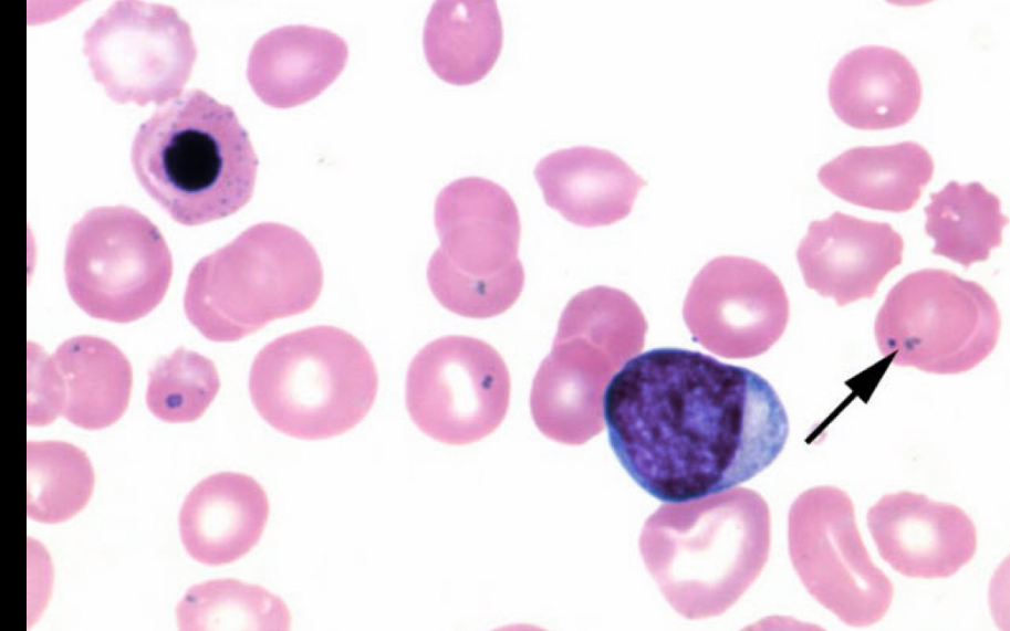 <p>What RBC is this? </p>